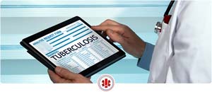 04 Questions to Ask About TB Testing Near Me in El Paso, TX and Horizon City, TX