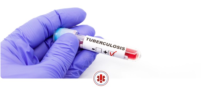 How Much Does a Tuberculosis (TB) Test Cost Near Me In El Paso and Horizon City TX?