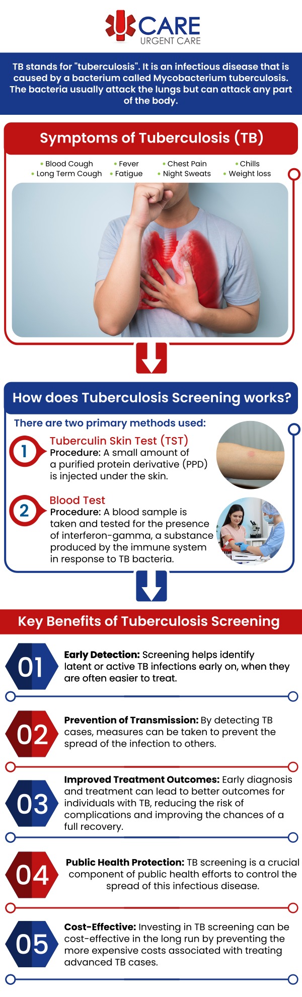 A tuberculosis screening test checks to see if you have the bacteria (germs) that cause tuberculosis (TB) in your body. UCare Urgent Care and Walk-In Clinic offer TB Testing near you. For more information, contact us today! We are a walk-in clinic located at Horizon City TX, on North Zaragoza Rd. in El Paso TX, and on Lee Trevino Dr. in El Paso TX. A tuberculosis screening test checks to see if you have the bacteria (germs) that cause tuberculosis (TB) in your body. UCare Urgent Care and Walk-In Clinic offer TB Testing near you. For more information, contact us today! We are a walk-in clinic located at Horizon City TX, on North Zaragoza Rd. in El Paso TX, and on Lee Trevino Dr. in El Paso TX.