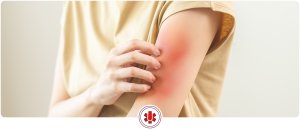 Can I Go to Urgent Care for Parasites? | UCare Urgent Care in Horizon City, TX